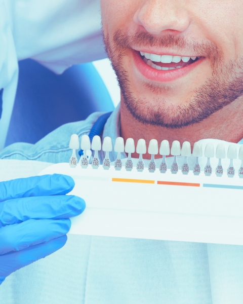 FACETAS DIRETAS DE RESINA COMPOSTA EM DENTES ANTERIORES